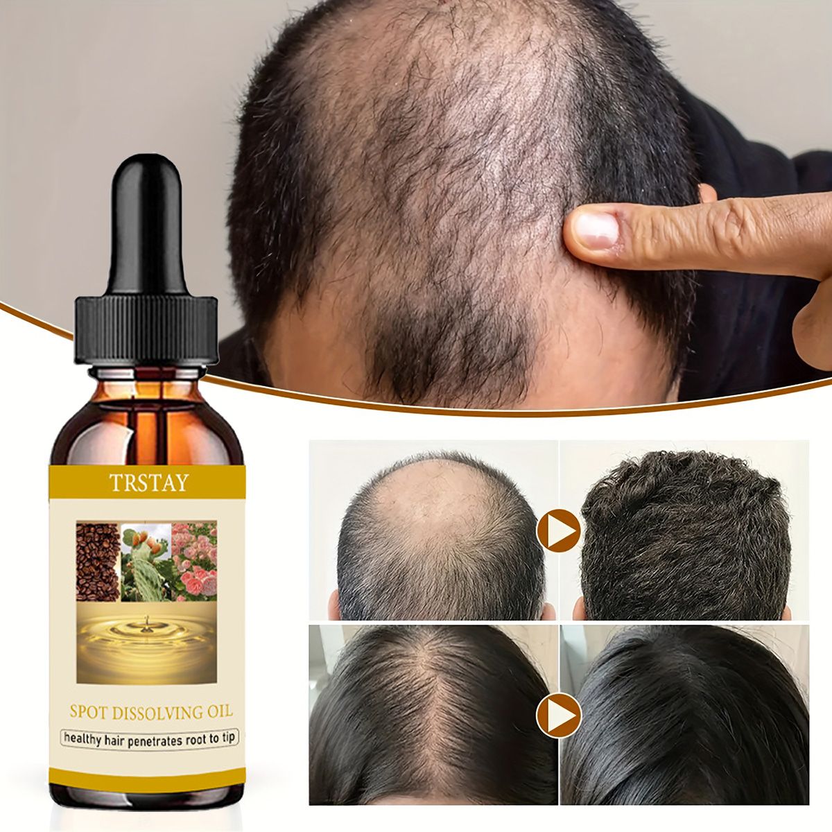 Beard Oil - 50ML Olio per la crescita della